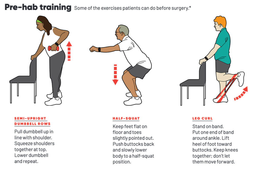Pre-hab training. Some of the exercises patients can do before surgery. 